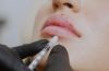 Every important thing you must know about Botox injections