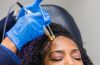 Here are some of the benefits of going for PRP hair treatment