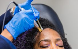 Here are some of the benefits of going for PRP hair treatment