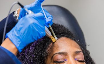 Here are some of the benefits of going for PRP hair treatment