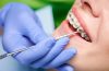 Dentists Assist with the Installation and Maintenance of Braces