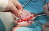 Restoring Comfort and Confidence How the Right Hernia Surgeon Can Transform Recovery