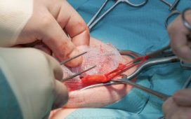 Restoring Comfort and Confidence How the Right Hernia Surgeon Can Transform Recovery