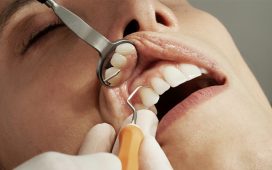 Why Dental Care Is Essential And The Role They Play