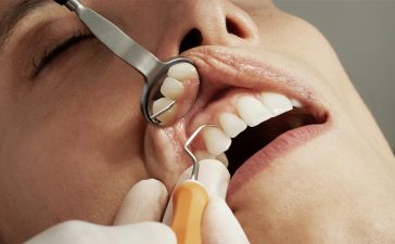 Why Dental Care Is Essential And The Role They Play