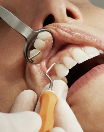 Why Dental Care Is Essential And The Role They Play