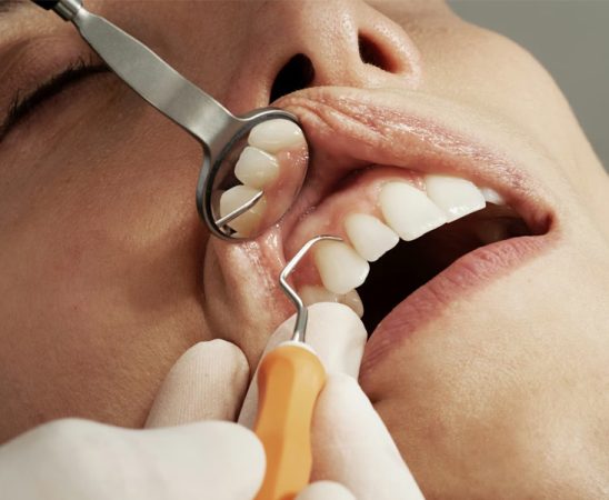 Why Dental Care Is Essential And The Role They Play