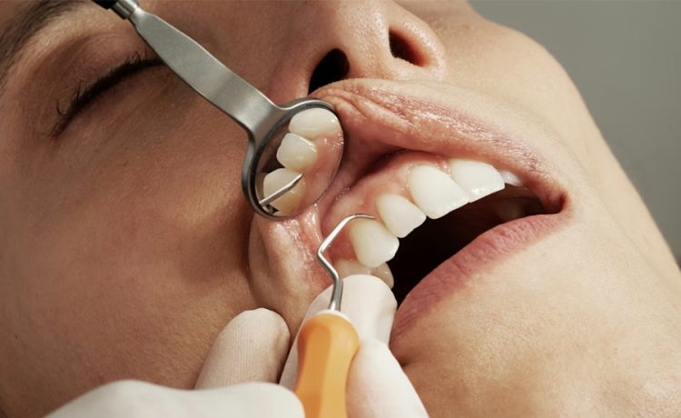 Why Dental Care Is Essential And The Role They Play