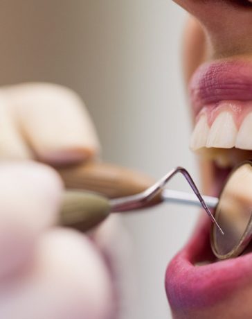 Why Regular Dental Care Is Important