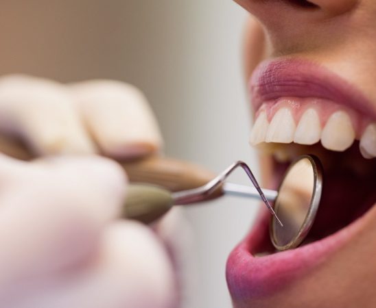 Why Regular Dental Care Is Important